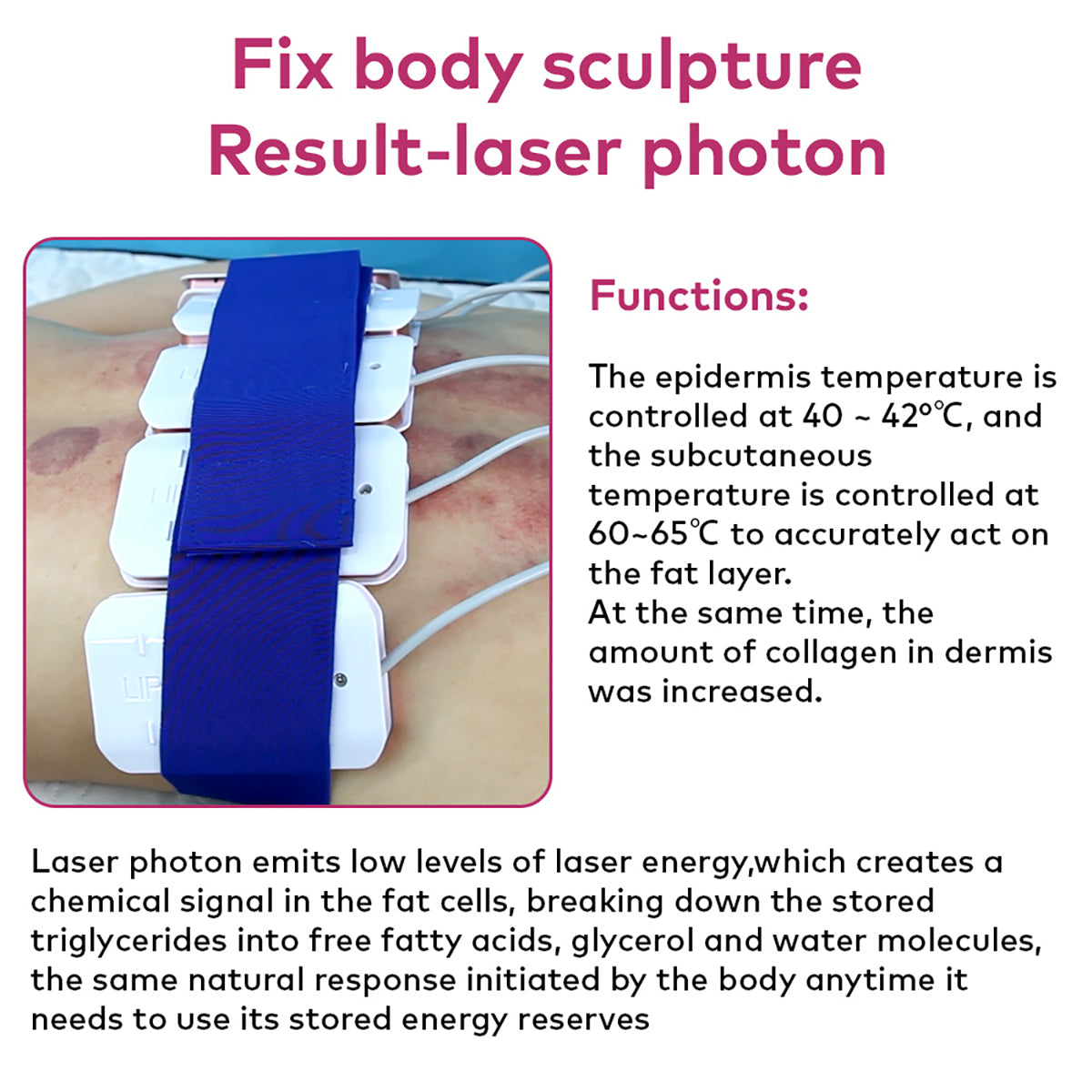SQ92D Plus 9-in-1 80K Ultrasonic Cavitation & RF Machine with Laser Pads