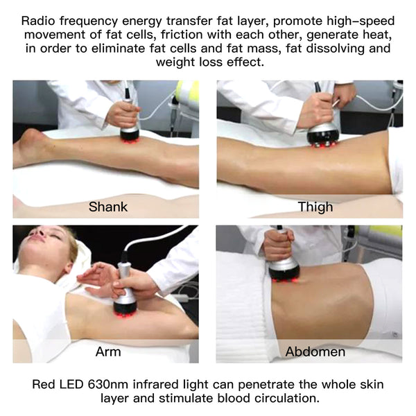 SQ48 Plus 9-in-1 40K Ultrasonic Cavitation & RF Machine with Laser Pads
